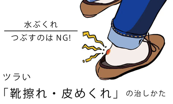 水ぶくれを潰すのはだめ！辛い靴擦れや皮めくれをを早く治すには？